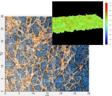 collagen crosslinks show up