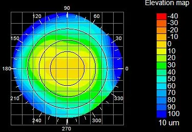 cornea topography shows up